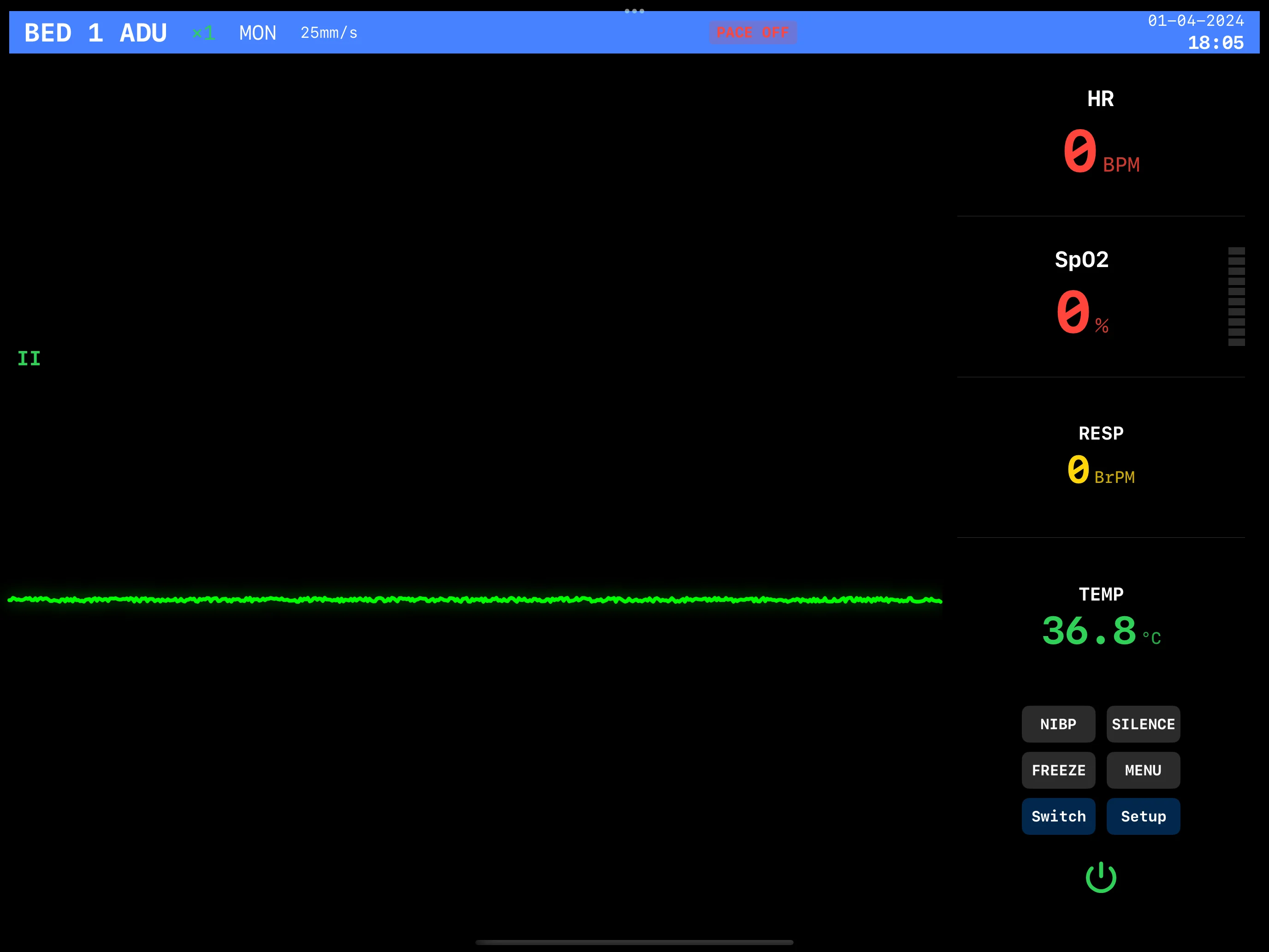 EKG Monitor Flatline Scenario