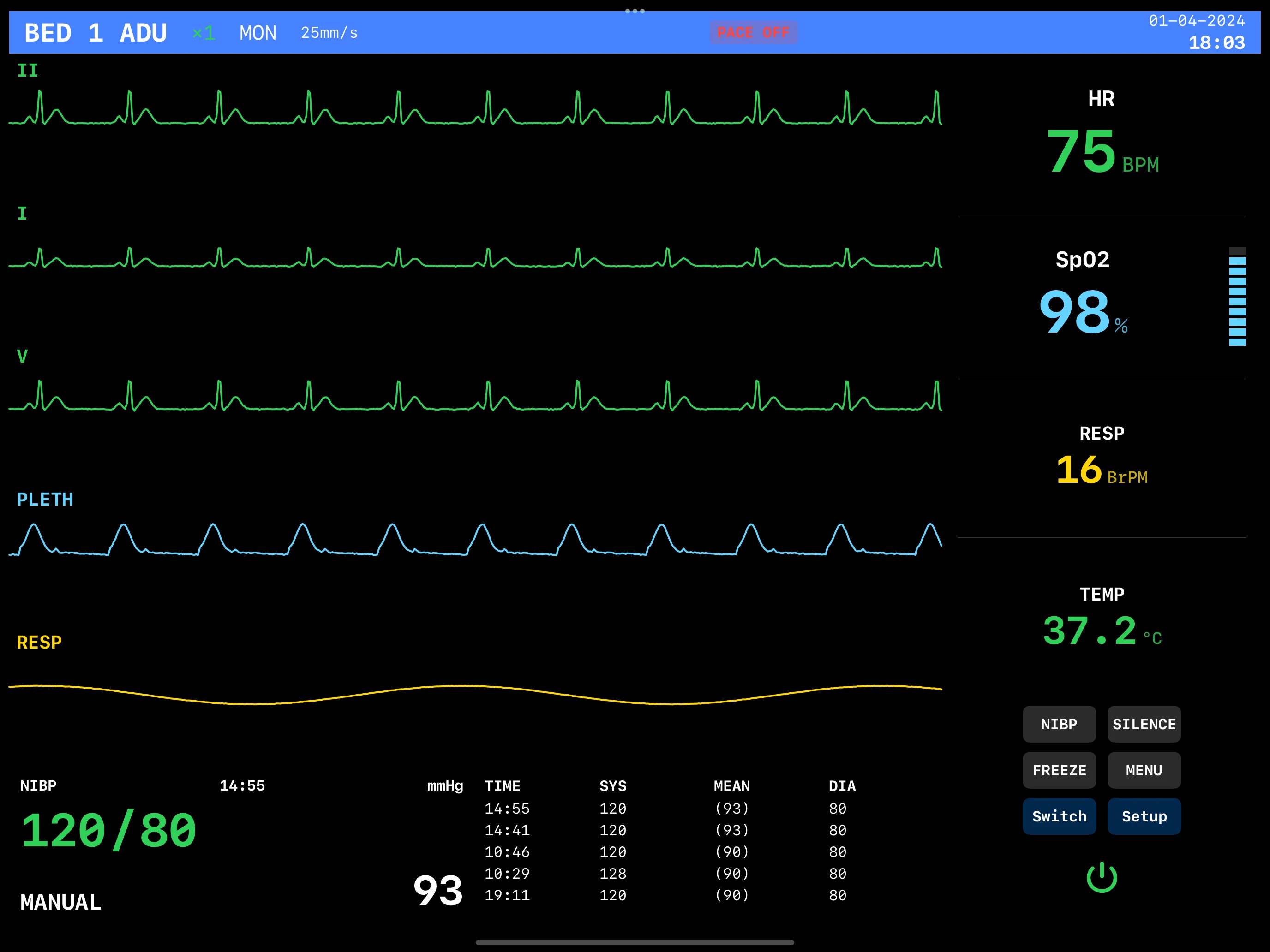 EKG Monitor Normal View