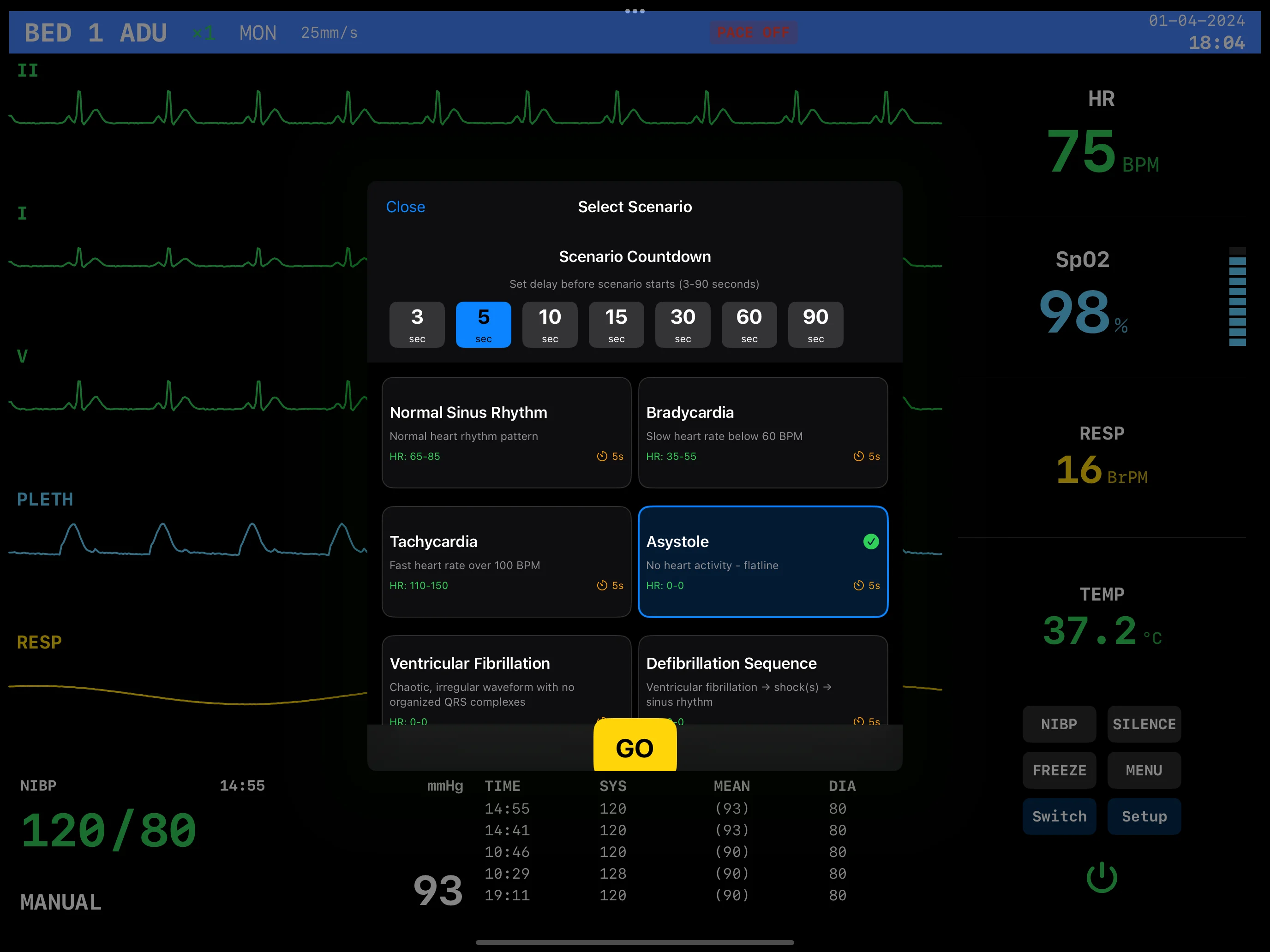 EKG Monitor Scenarios