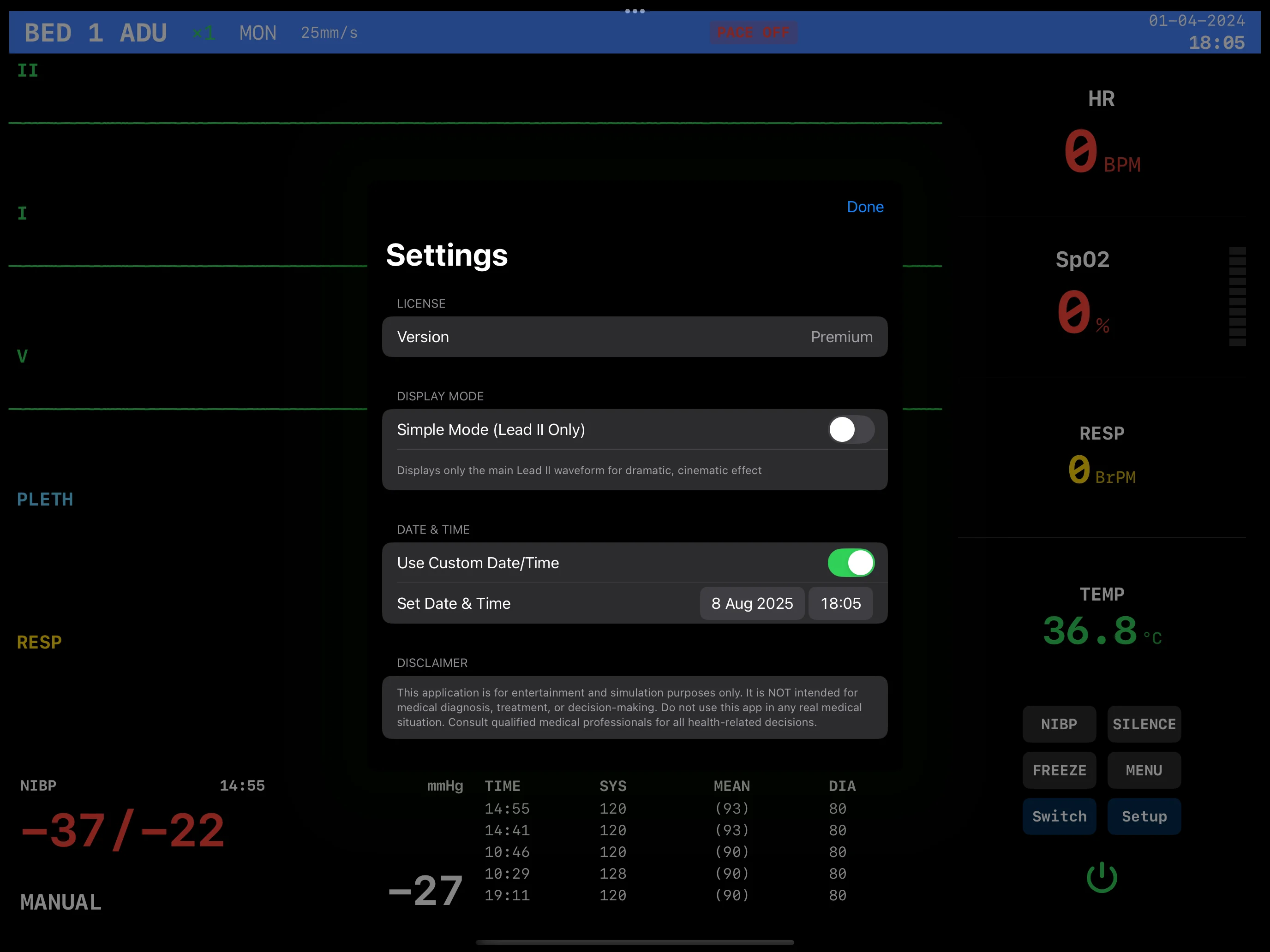 EKG Monitor Settings