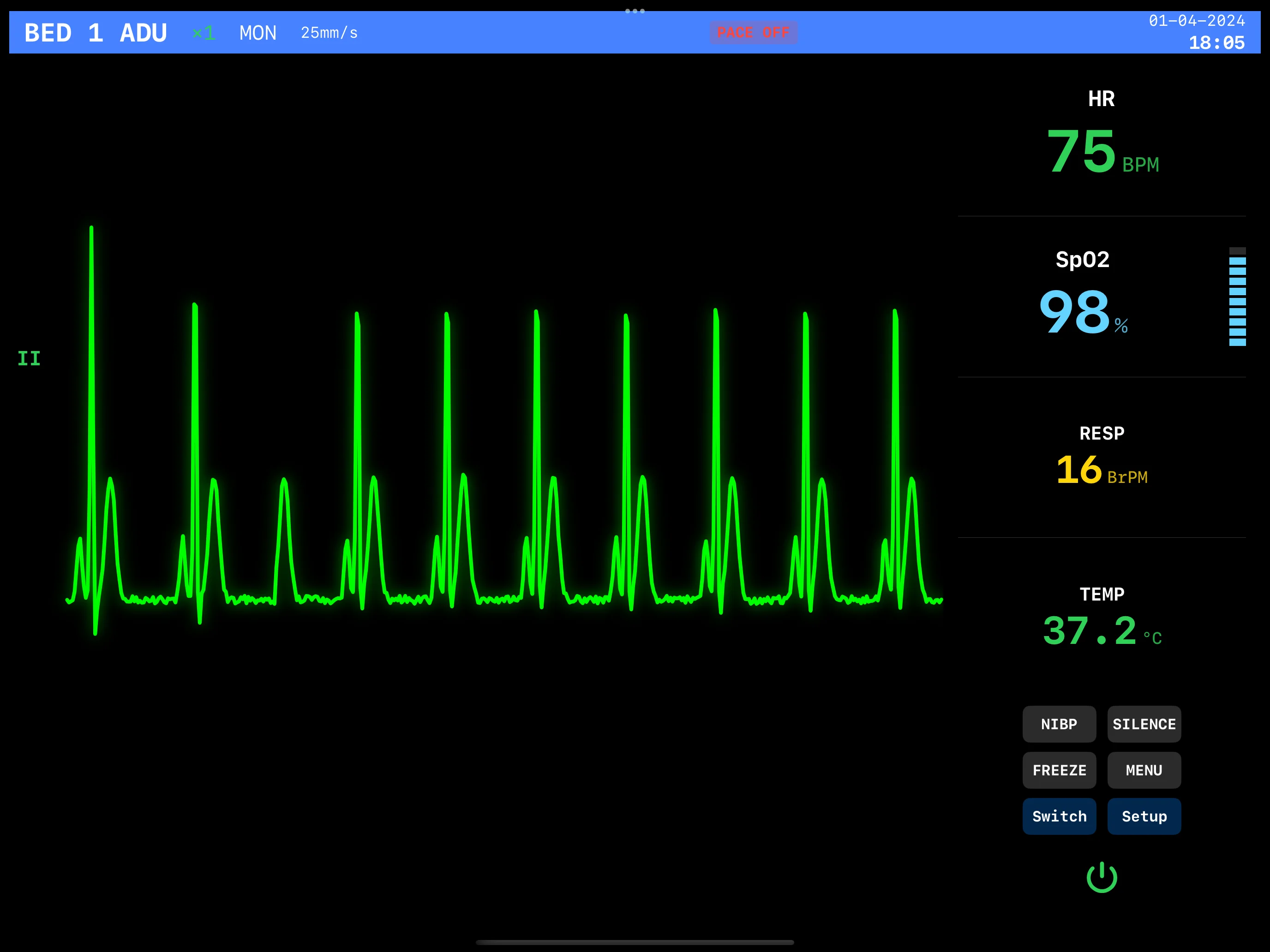 EKG Monitor Simple Mode